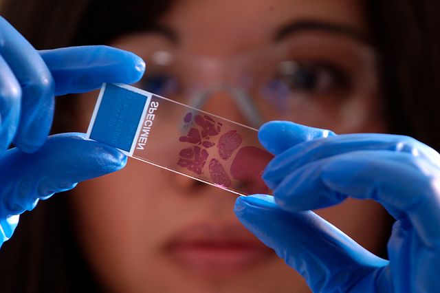 تحاليل علم الأمراض في مختبر مركز الآفاق للرعاية الطبية في عبري - الدريز