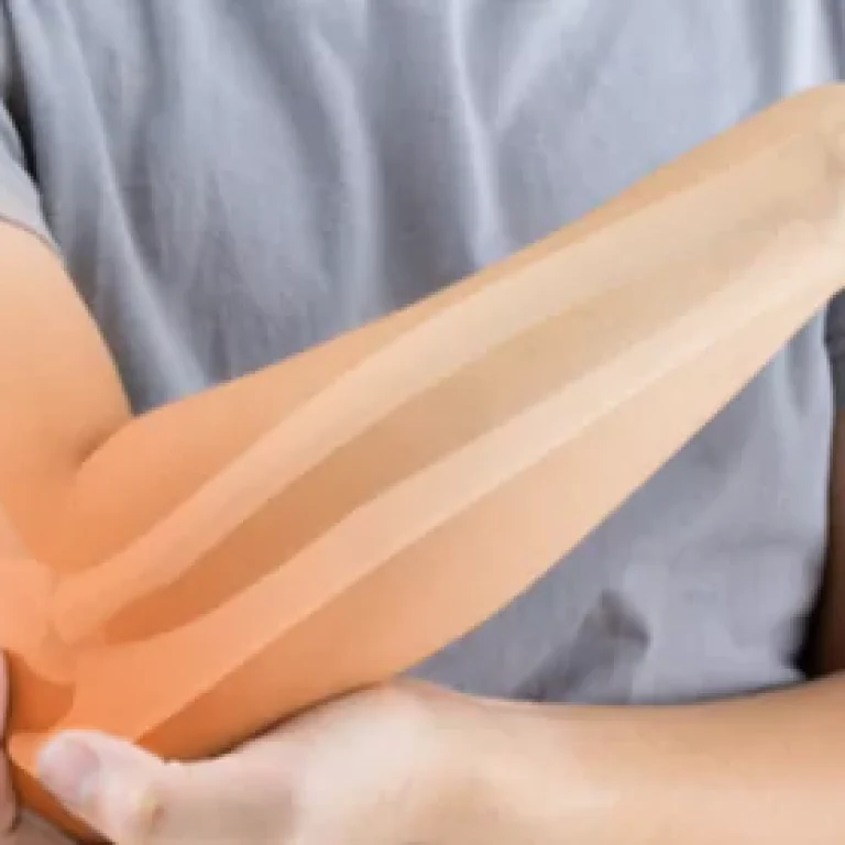 bone-diseases-treatment