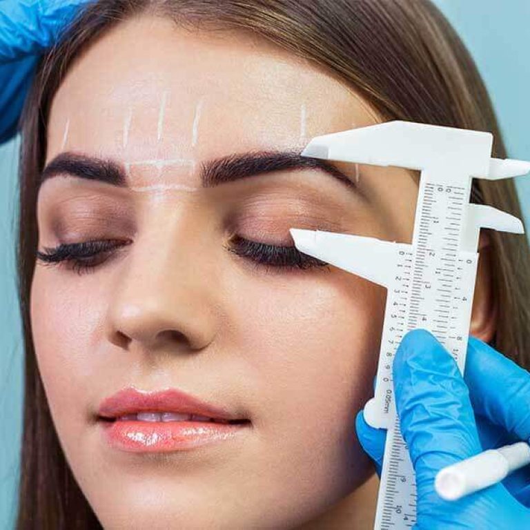 brow-lift-surgery