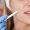 cheek-augmentation