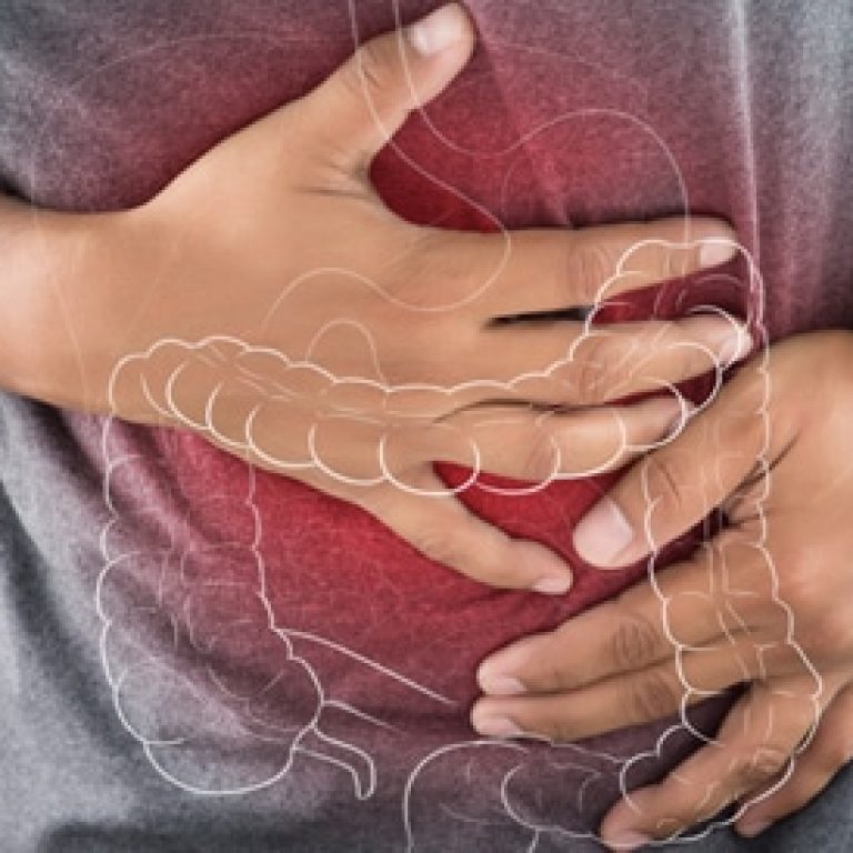 colon-disorder-treatment