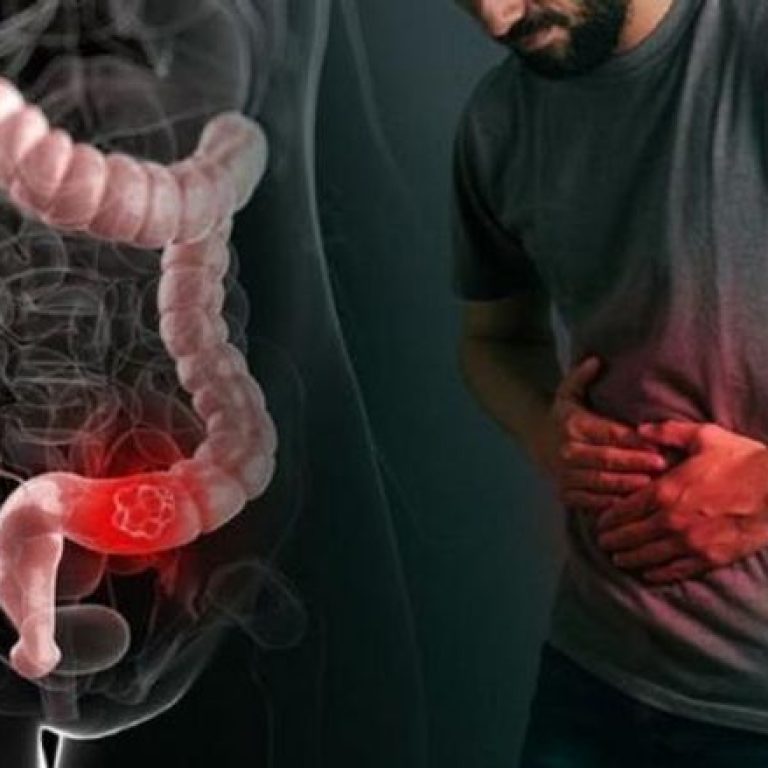 constipation-treatment