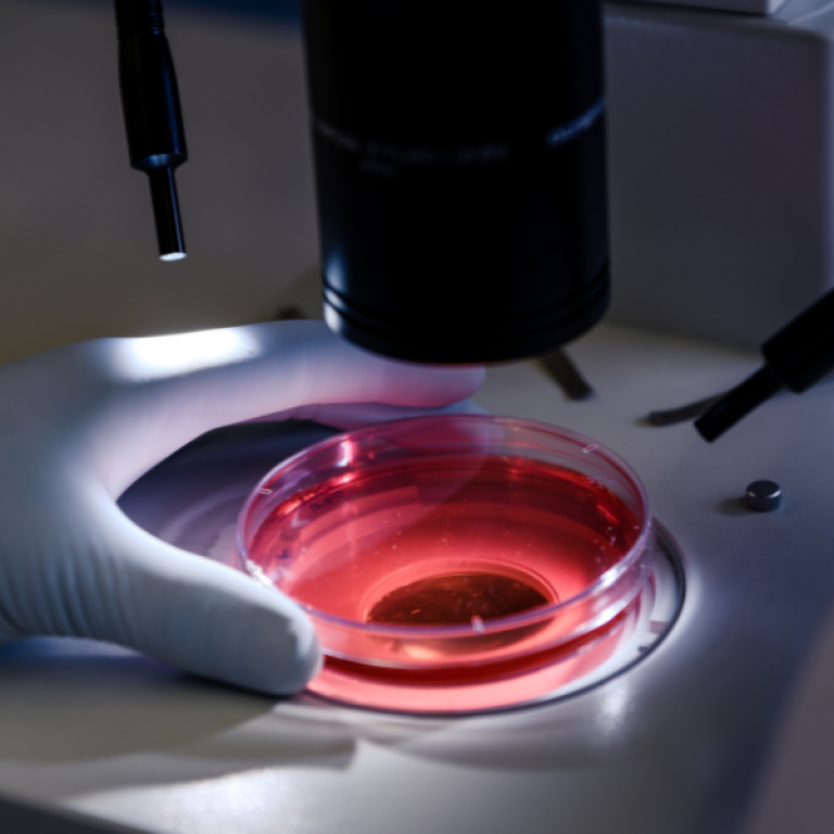 تحاليل علم الخلايا في مركز الآفاق للرعاية الطبية في عبري - الدريز