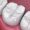 dental-fillings