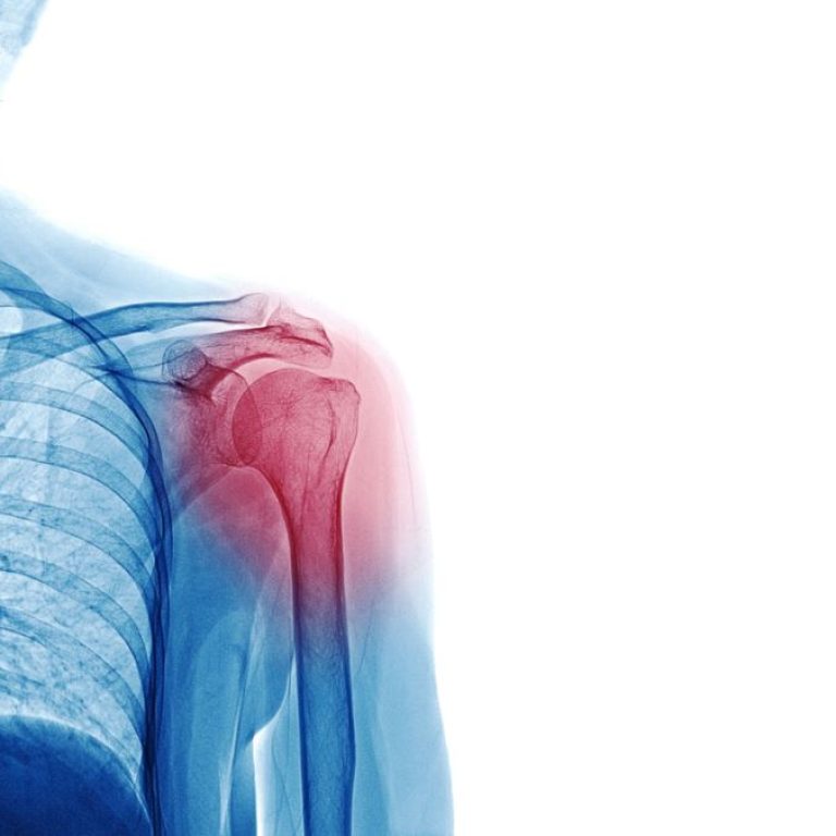 dislocation-treatment