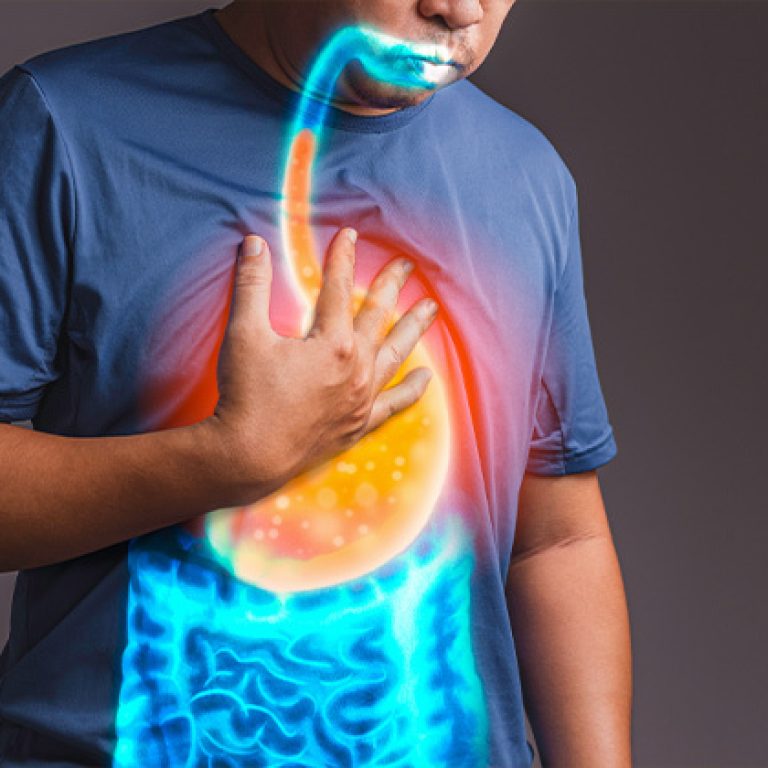 esophageal-reflux-treatment