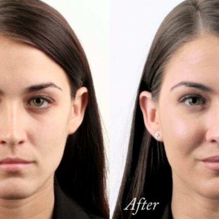 face-contouring-treatment