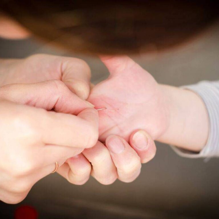 foreign-body-removal-radiological-intervention