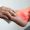gout-treatment