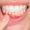 gum-disease-treatment