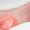 heel-spur-treatment