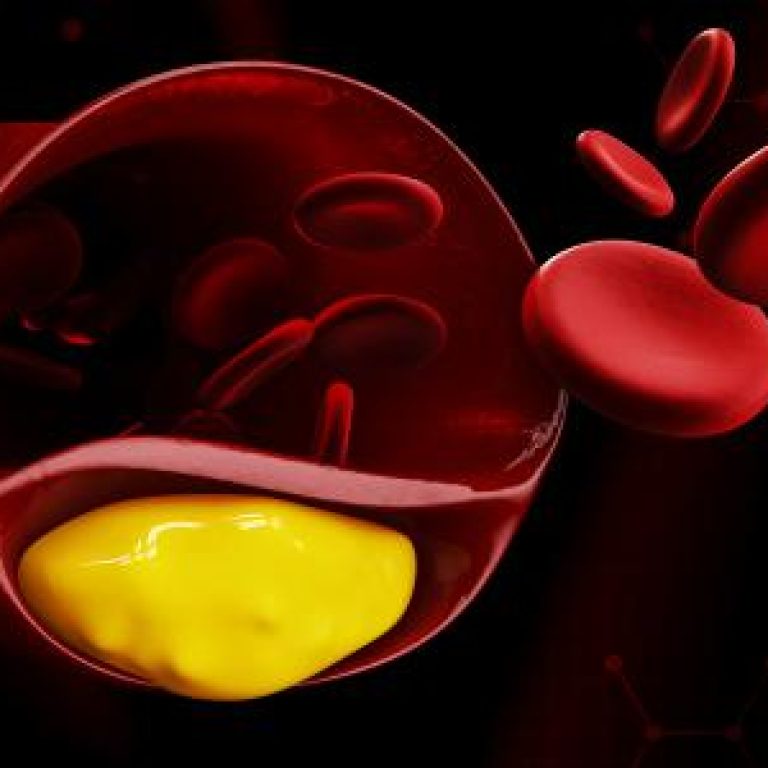 high-cholesterol-treatment