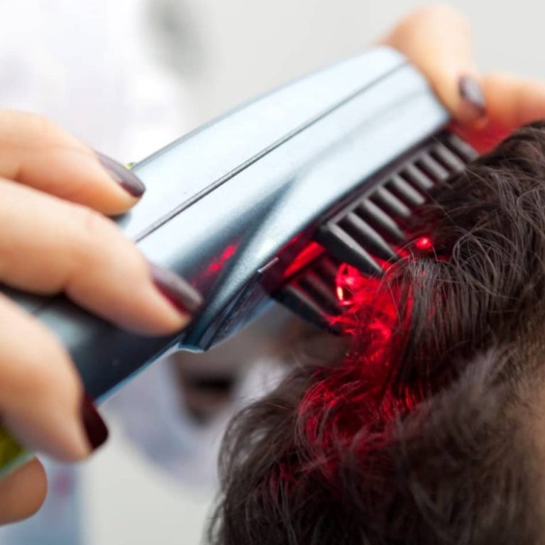 laser-hair-growth-stimulation