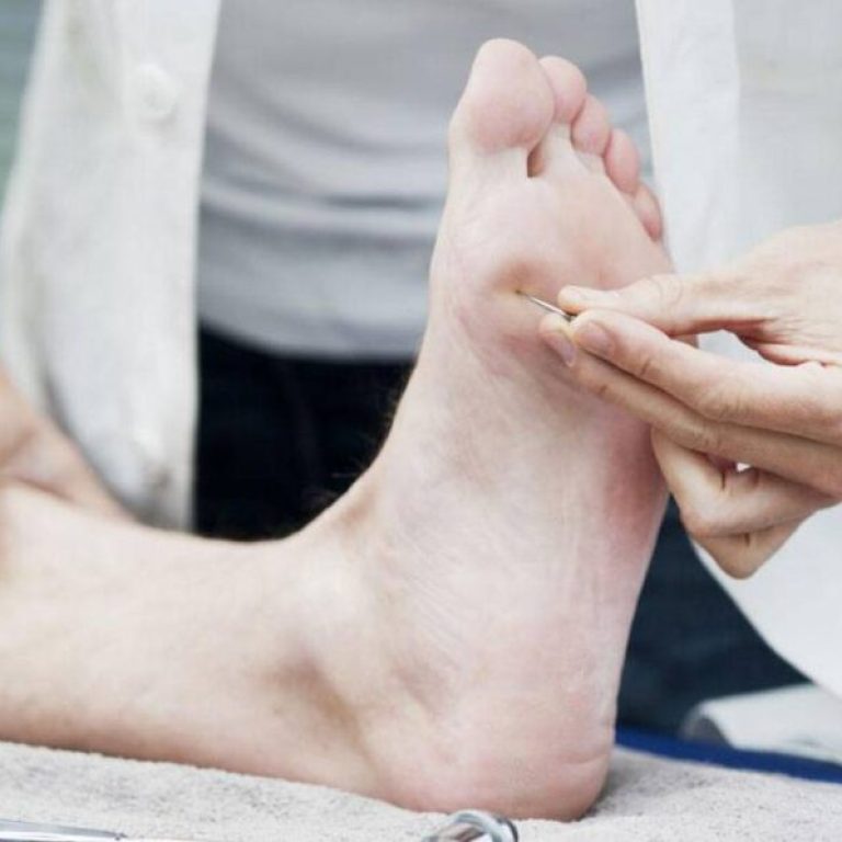 peripheral-neuropathy-treatment