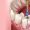 root-canal-treatment