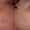 skin-pigmentation-treatment