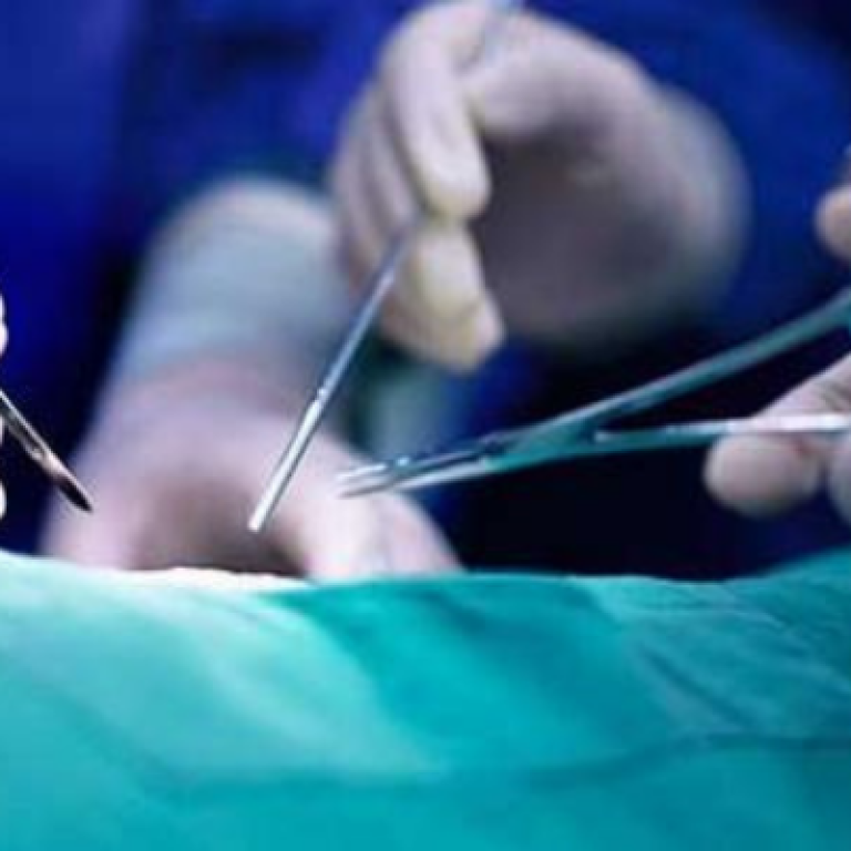 surgical-vaginal-tightening