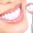 teeth-cleaning-polishing