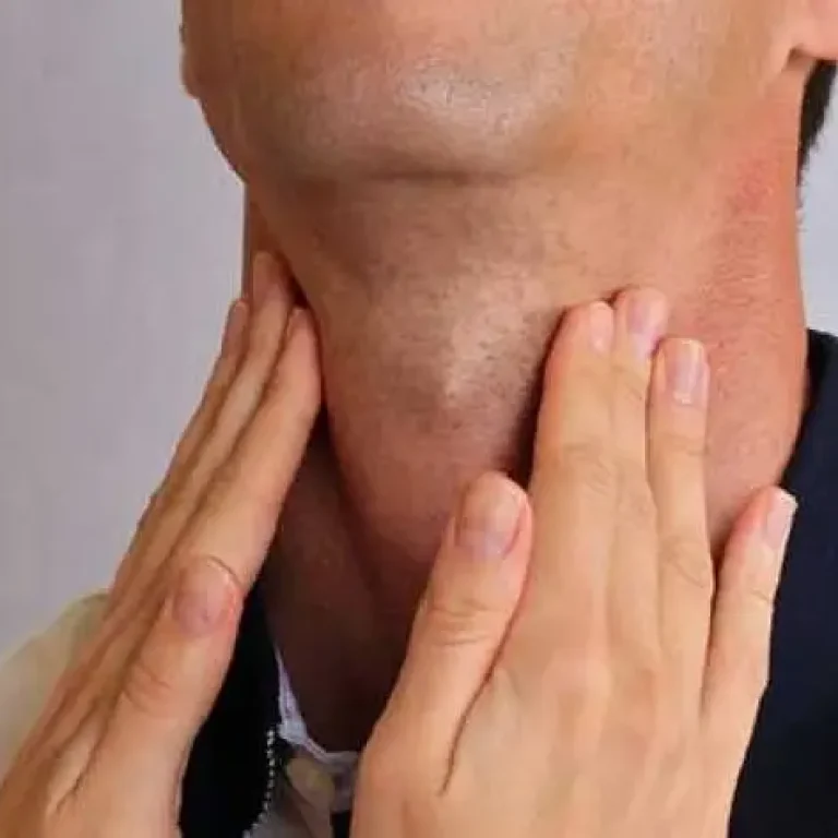 thyroid-diseases-treatment