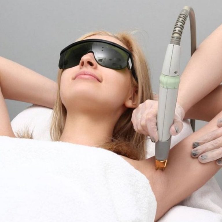 underarm-laser-whitening