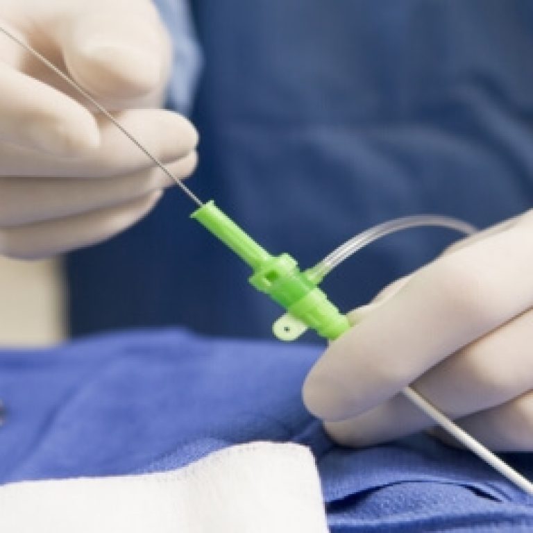 urinary-catheter-insertion-removal