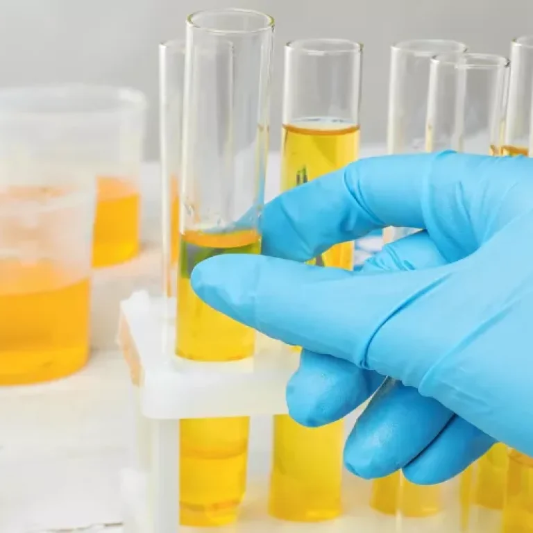 تحليل البول في مختبر الآفاق للرعاية الطبية بعبري