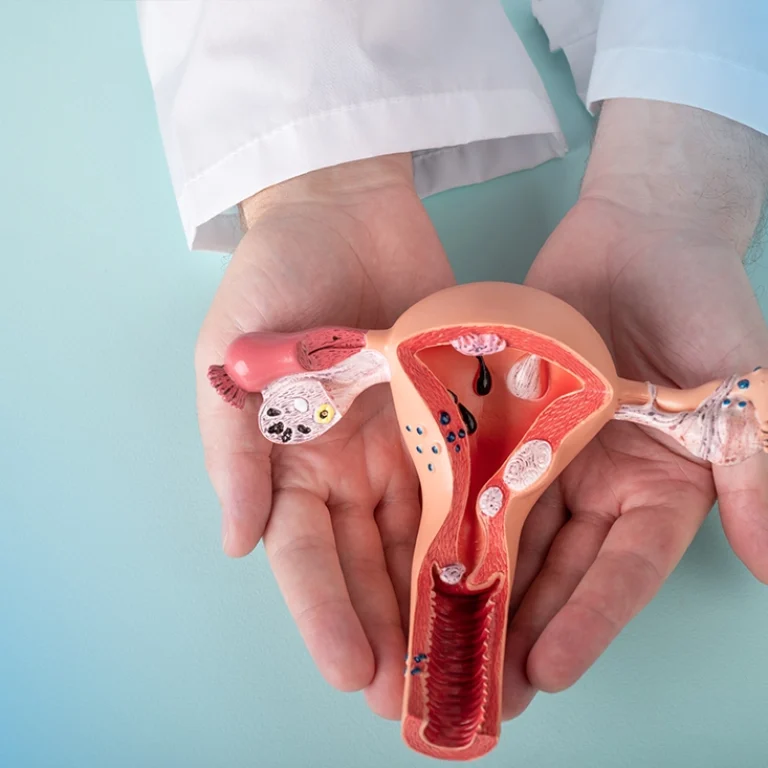 vaginal-laser-tightening