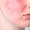 vascular-treatments