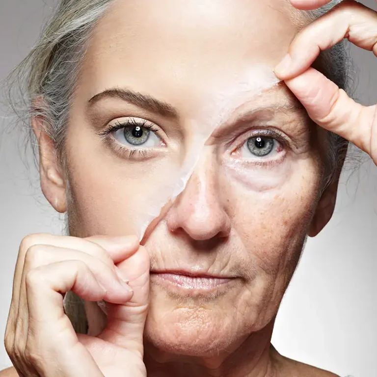 wrinkle-reduction-treatment